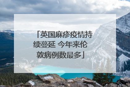 英国麻疹疫情持续蔓延 今年来伦敦病例数最多